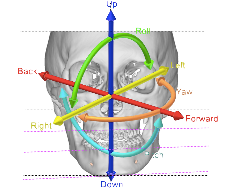 RECUO MAXILO-MANDIBULAR - CLINICA DA FACE